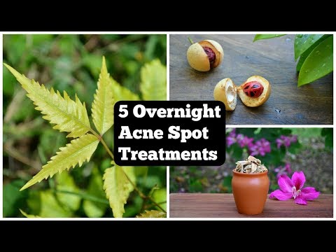  Overnight Acne Spot Treatments That Will Vanish Pimples Overnight !