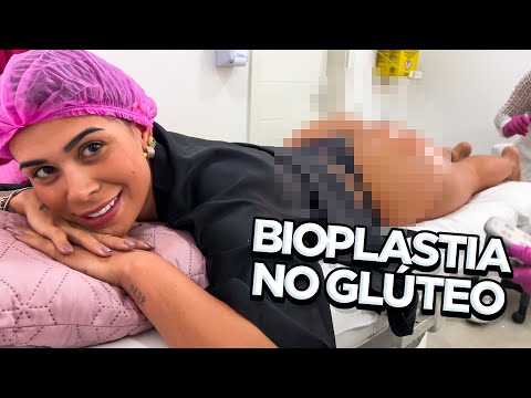 FIZ BIOPLASTIA NO GLÚTEO E MOSTREI O RESULTADO!!!