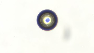 Pollen in honey under microscope