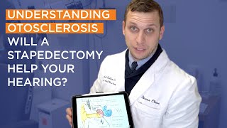Understanding Otosclerosis Part 6 | Will a Stapedectomy Help my Hearing? by House Institute 2,245 views 1 year ago 2 minutes, 27 seconds