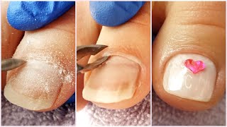 Toenails Cleaning 💖  DIY Pedicure at Home 💖 Pedicure Tutorial by I'm kitting! 7,317 views 4 years ago 21 minutes