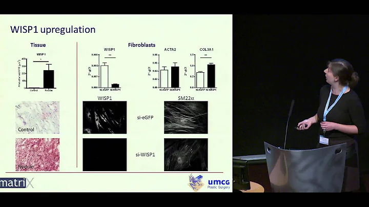 Dr. Marike van Beuge: "Wnt pathway signals" 2015 Dupuytren Symposium