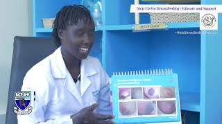KNH Nutrition Department | Breast conditions related to breastfeeding
