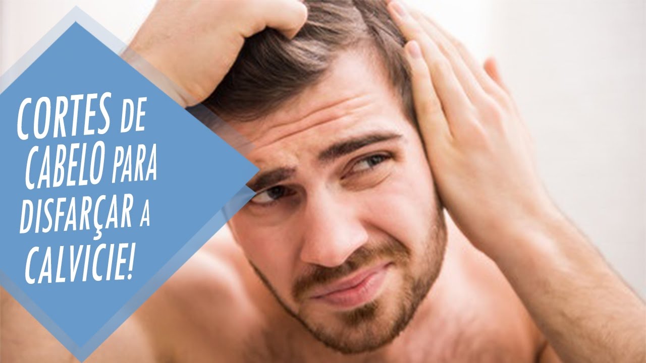 corte de cabelo masculino para calvos