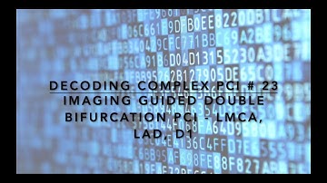 Imaging Guided Double Bifurcation PCI - LMCA, LAD D1 - Live Case by Dr. Sharath Reddy Annam