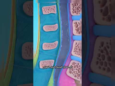 ما هو البزل القطني كل ما تحتاج معرفته عن هذا الإجراء الطبي