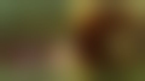 Soft Polar Cataract - how to overcome the surgical challenges during Phacoemulsification