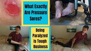 Paraplegic Pressure Sores & The Wheelchair Life by Living Differently  1,669 views 9 months ago 10 minutes, 42 seconds