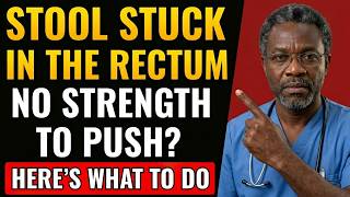 Stool STUCK in the Rectum! What is it and what to do? | Doctor Explains