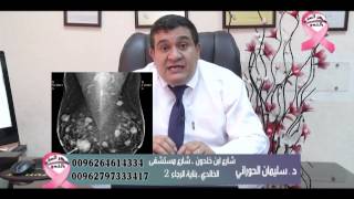 الدكتور سليمان الحوراني - تكلسات الثدي