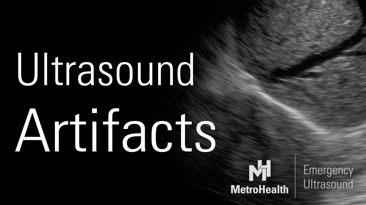 Artifacts – basic concepts in ultrasound physics