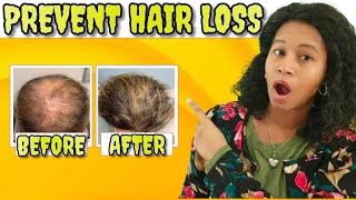 15 Proven Remedies to Prevent Hair Loss and Regrowth Regrow Hair Fast & stop hair Fall