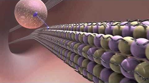 Inside the Brain: Unraveling the Mystery of Alzheimer