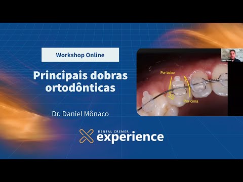 Aulas Dental Cremer Experience | Workshop Online: principais dobras ortodônticas