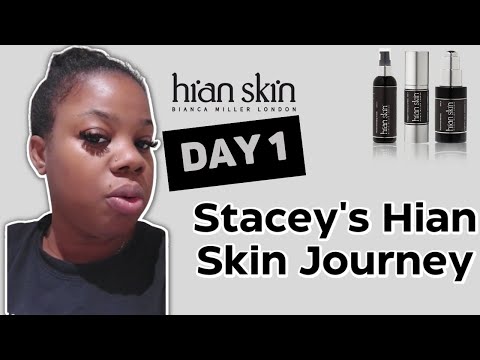 Stacey's Hian Skin Journey Day One - Hian Skin - Bianca Miller London