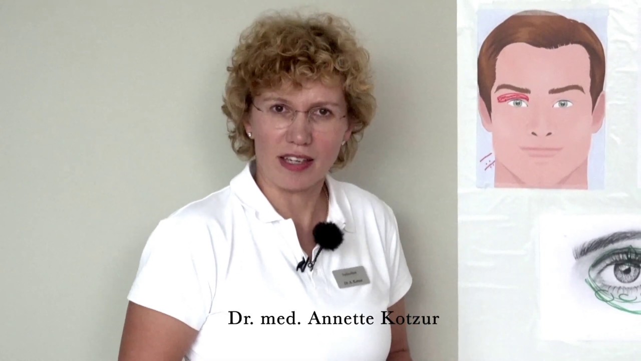 Was tun bei Tränensäcken | Augenringen | Unterlidstraffung Teil 2 ...