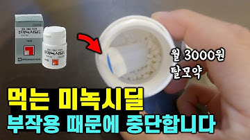 미녹시딜안면부종 - Youtube