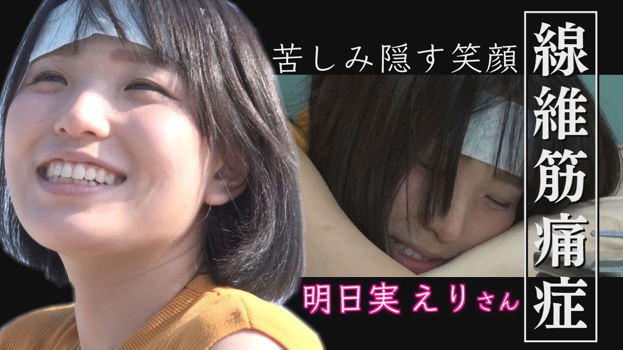 「線維筋痛症」明日実えり 苦しみ隠す笑顔 自立への葛藤