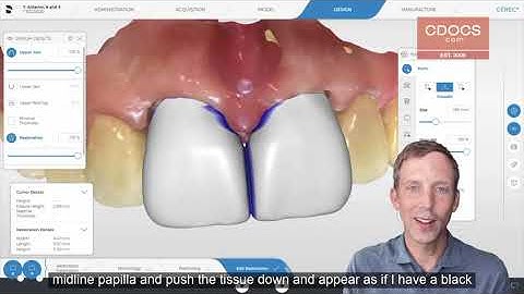 Tip of the Day: Checking Papilla with Biocopy