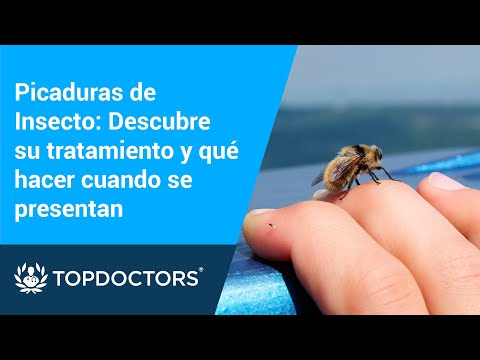 Vídeo: Pruebas De Alergia A Picaduras De Insectos