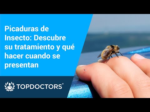 Picaduras de Insecto. Descubre su tratamiento y que hacer cuando se presentan