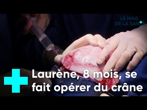 Vidéo: Chirurgie Reconstructrice