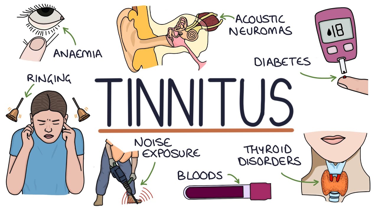 Understanding the Causes of Tinnitus - YouTube