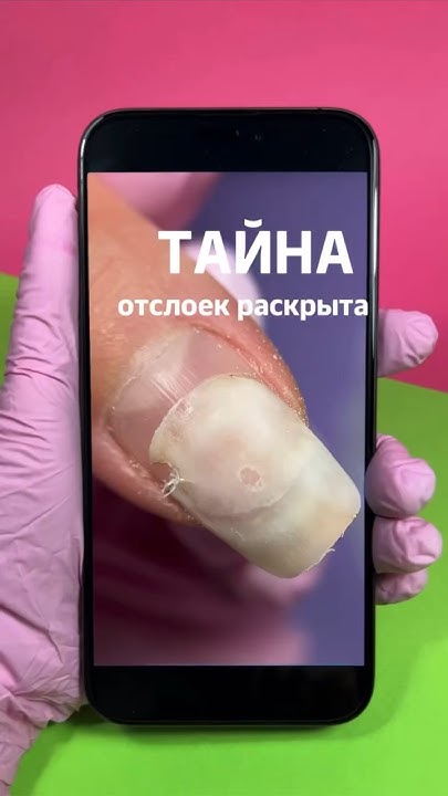 ПРИЧИНЫ ОТСЛОЕК 👉🏻неправильная подготовка НП и некачественные материалы ...