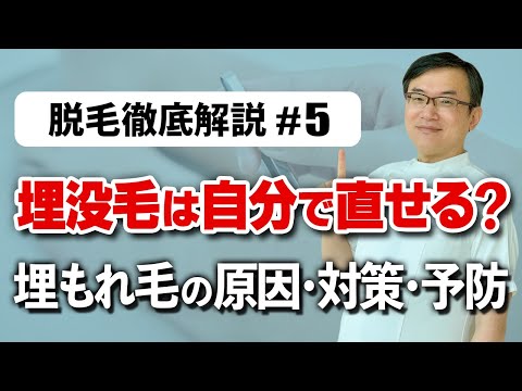 埋没毛は自分で治せる？埋もれ毛の原因・対処・予防法