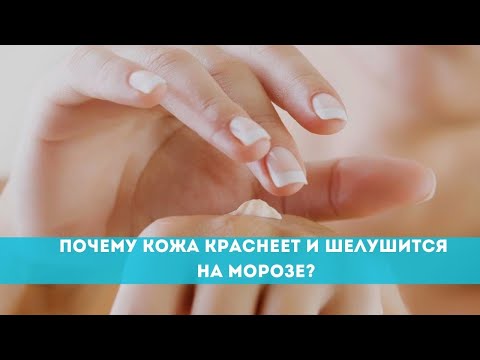 Почему кожа краснеет и шелушится на морозе?