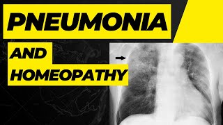 pneumonia || homeopathic medicine for pneumonia !