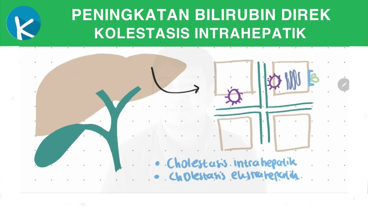 Patofisiologi Ikterus (2A/2B) Peningkatan Bilirubin Direk (Kolestasis