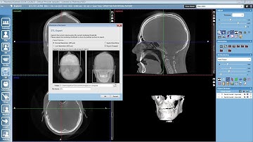 Converting 3D Volumes into .stl Files in Planmeca Romexis©