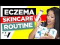 Doctors Eczema Routine - Products that help my eczema | Facial eczema | How I clear my eczema