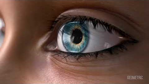 Dry Eye Syndrome medical animation by Geometric Medical
