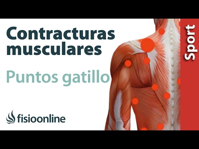Contractura muscular espalda baja sintomas