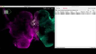 Image alignment in BigStitcher using translation-invariant interest point matching