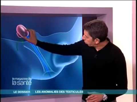 Vidéo: Astragale Testiculaire