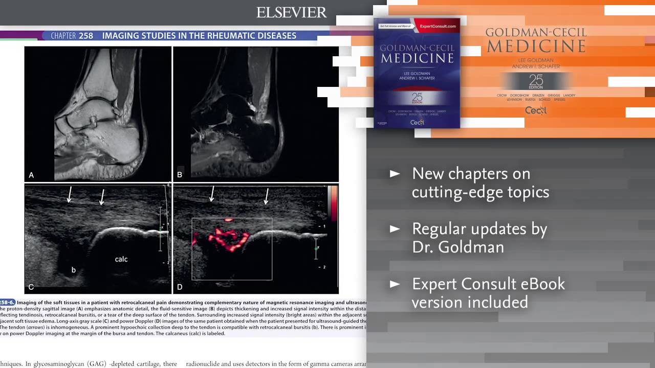 Goldman-Cecil Medicine, 25th Edition - YouTube