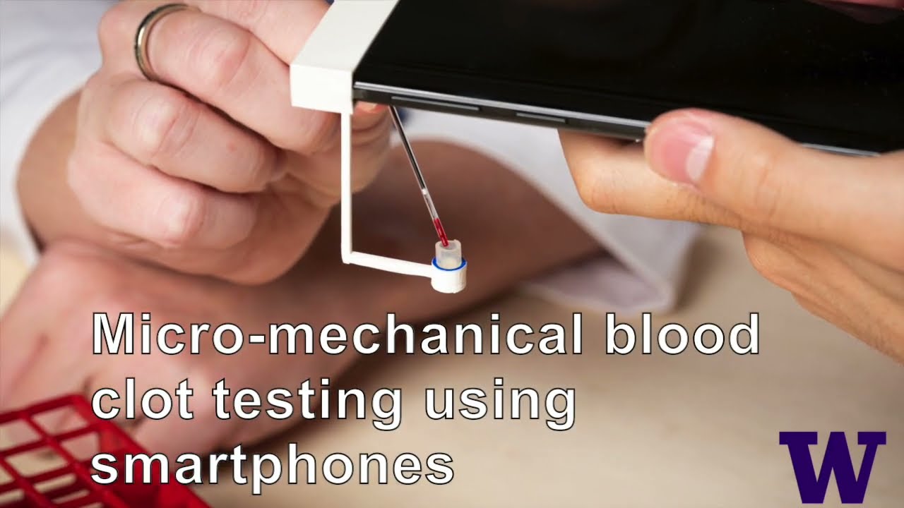 Smartphone system developed by Univ. of Washington researchers