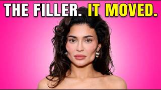 They paid for the perfect face. Then the filler moved.