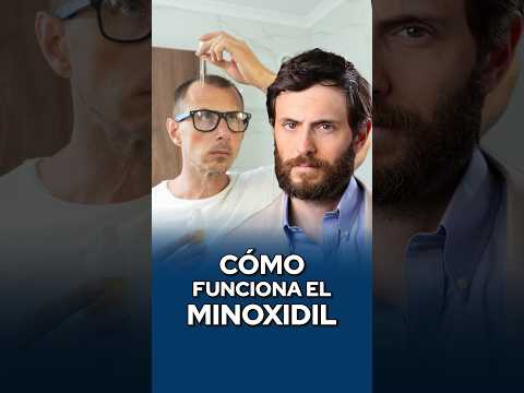 ¿Cómo funciona el Minoxidil?