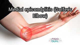 Medial epicondylitis (Golfer's Elbow)