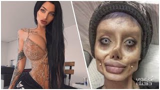 10 اشخاص وصلوا لأقصى الحدود فى عمليات التجميل !