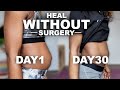 I Tried Top Exercises to Heal Diastasis Recti NATURALLY for 30 DAYS &amp; this Happened