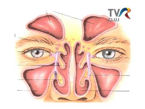 Video: Sinuzită Cronică - Simptome, Tratament La Adulți