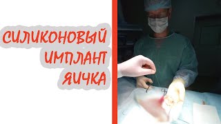 Силиконовый имплант яичка / Доктор Черепанов
