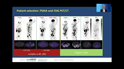 TheraP Study: Lu-PSMA vs. cabazitaxel #ASCO20 #ANZUP