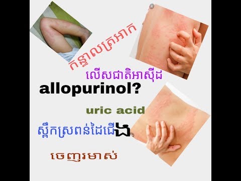allopurinol, ថ្នាំបន្ថយជាតិអាសុីដក្នុងឈាម,  uric acid, ស្ពឹកស្រពន់ដៃជេីង