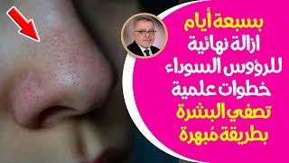 طريقة سهلة للتخلص من الرؤوس السوداء خلال 7 أيام علاج الوجه جمال العناية بالبشرة إزالة الرؤوس السوداء